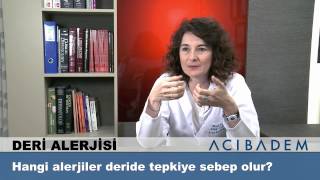 Hangi alerjiler deride tepkiye sebep olur [upl. by Apps941]