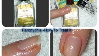 Acute Chronic PARONYCHIA Treatments [upl. by Zednanreh]