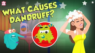 What Causes Dandruff  How To Treat Dandruff  The Dr Binocs Show  Peekaboo Kidz [upl. by Shepp]