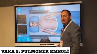 VAKA SİMÜLASYONU PULMONER EMBOLİ [upl. by Eemla417]