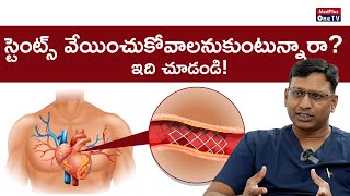 Stents for Heart Blood vessel Treatment amp Types of Stents [upl. by Inaffit]