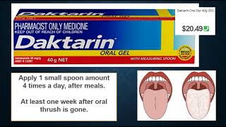 Daktarin oral thrush miconazole OTC Roze pharm [upl. by Ellennahc]