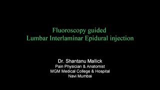 Lumbar epidural technique fluoroscopy guided by Dr Shantanu Mallick [upl. by Aminta846]