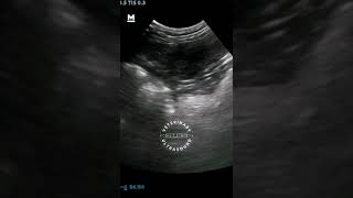 Ultrasound of a splenic nodule in a dog [upl. by Daron251]