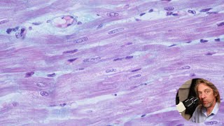 Microscopic anatomy of cardiac muscle [upl. by Halfon]