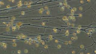 foraminiferal rhizopodia [upl. by Primalia]