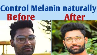 How to reduce melanin in skin naturally  Melanin kam karne ke upay [upl. by Ashti]