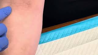 3 Tips For Locating DIFFICULT Veins  Phlebotomy Tip  Medical Assistant Training [upl. by Ahsiekam]