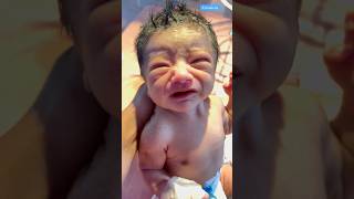 Newborn babies crying medical viralvideo [upl. by Lippold]