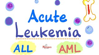 Acute Leukemia  ALL and AML  Hematology and Oncology Series [upl. by Eduj]