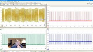 PicoScope  NOT just for the Advanced Level Diagnostician [upl. by Anitram]