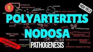 POLYARTERITIS NODOSA Pathogenesis Mechanism of Clinical symptoms Treatment [upl. by Zetnod870]