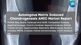 Autologous Matrix Induced Chondrogenesis AMIC Market Report [upl. by Nwahsem]