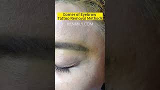 Eyebrow Tattoo Removal Before And AfterPicosecond Laser Tattoo China Laser Beauty Machine Supplier [upl. by Tenaej318]