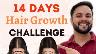 14 Days Extreme Hair Growth Challenge Thicker amp Longer Hair in 2 Weeks [upl. by Atniuqal]