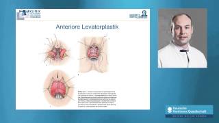 N Habbe Stuhlinkontinenz  Diagnose Risiken und Therapien [upl. by Wiedmann]