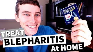 What is Blepharitis How to Treat Blepharitis at Home [upl. by Gnoz73]