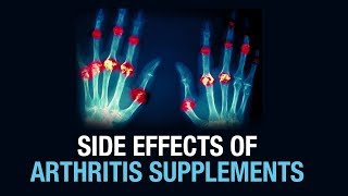 Side effects of Arthritis Supplements  Dr Gaurav Sharma  Defeating arthritis [upl. by Netti974]