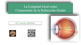 La Longitud Axial del Ojo Humano como Componente de la Refracción Ocular [upl. by Neellek]