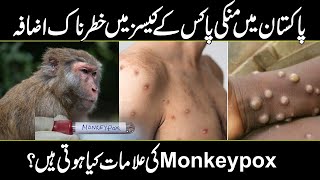 Alert  Monkey pox Virus Spreading in Pakistan  Symptoms amp Causes amp Treatment [upl. by Ryley]