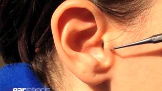 Tranquilizer Auriculotherapy Ear Point [upl. by Anett]