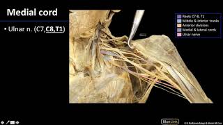 Brachial Plexus Shoulder amp Brachial Plexus  Dissection Supplement [upl. by Liatrice]