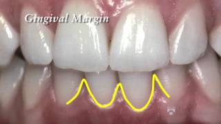 Lecture 3 Periodontium and Periodontal Disease [upl. by Nordine617]