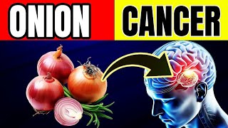 Never Eat Onions with THESE Foods 🧅 Causes Cancer and Memory Loss [upl. by Weston822]