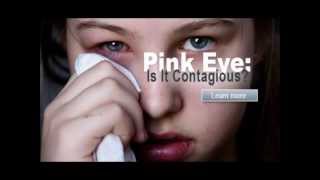 how to get rid of pink eye  conjunctivitis treatment  how to get rid of pink eye fast [upl. by Ellehcit]