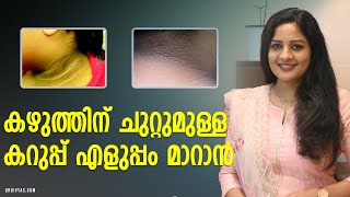 കഴുത്തിന് ചുറ്റുമുള്ള കറുപ്പ് എളുപ്പം മാറാൻ  HOW TO GET RID OF DARK NECK FAST amp NATURALLY [upl. by Samaria]