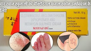 Surfaz SN Cream use benefits and side effects full review in hindi surfaz sn cream surfaz cream [upl. by Rida]