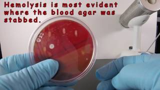 Beta Hemolysis on Blood Agar [upl. by Aerbas]