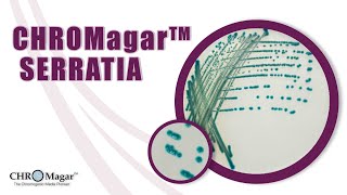 New Chromogenic Media for detection of Serratia marcescens CHROMagar Serratia [upl. by Atarman]