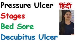 Pressure Ulcer  Stages of Pressure Ulcer  Bed Sores  Decubitus Ulcer  RajNEET Medical Education [upl. by Aicital621]