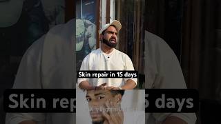 Skin repair youtubeshorts youtube [upl. by Derinna769]