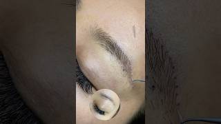 hairtransformation eyebrowtransplantation eyebrows 改眉 [upl. by Buffo561]