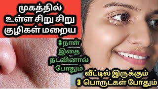 How to get rid of open pores at home in tamil natural ingredients jasvikamedia [upl. by Atat]