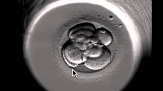 ivf embryo developing over 5 days by fertility Dr Raewyn Teirney [upl. by Havard227]