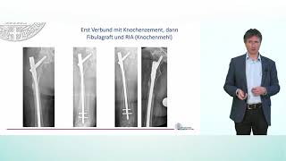 Chirurgische Optionen bei Knochenmetastasen im Bereich der Extremitäten  Prof Dr Hagen Schmal [upl. by Latsyrc916]