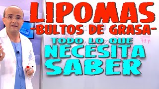 LIPOMAS BULTOS DE GRASA  Todo lo que necesita saber  Enfermedades 36 [upl. by Khanna]