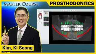 Master Course Season2 PROSTHODONTICS Diagnosis and Treatment Plan for Implant Placement [upl. by Cod]