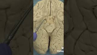 Medial temporal lobe parahippocampal gyrus neuroanatomy temporallobecortexlimbic system [upl. by Odlanyer]