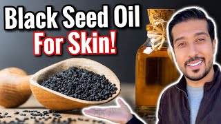 How to Use Black Seed Oil for Acne Scars Eczema and Wrinkles [upl. by Fara]