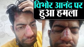 Sushant Singh Rajput case Lawyer Vibhor Anand पर हमला खुद तस्वीरे शेयर कर बताई घटना [upl. by Aitnecserc]