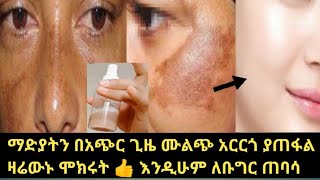 የማድያት ማጥፊያ ሙልጭ አድርጎ የሚያጠፋ 👍ዛሬውኑ ተጠቀሙት ብዙ ሴቶች የመሰከሩለት ዋው remove pigmentation on face home remedies [upl. by Theodoric]