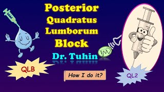 Posterior Quadratus Lumborum Block  QLB2  ultrasoundguided  Quadratus LumborumQL Block Type 2 [upl. by Kotta]