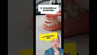 🤔Unveiling the Bite Types Find out YOUR dominant Chomping Pattern shorts dentallan bite teeth [upl. by Ancel]