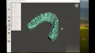 Using MeshMixer for making dental model [upl. by Enoryt]