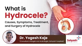 What is Hydrocele  Causes Symptoms Treatment and Surgery of Hydrocele  Dr Yogesh Kaje [upl. by Spencer]