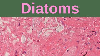 What are Diatoms  Pathology mini tutorials [upl. by Dubenko250]